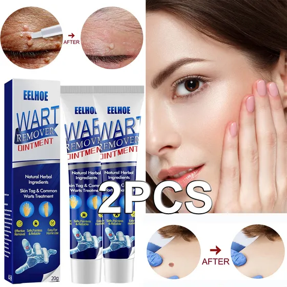 Crema Removedora De Lunares Y Verrugas, Indolora, 2 Unidades
