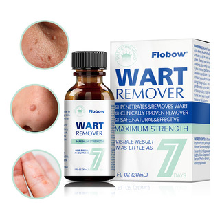 Tratamiento Y Eliminación De Verrugas Y Vph Tratamiento Y Eliminación De Verrugas Y Vph