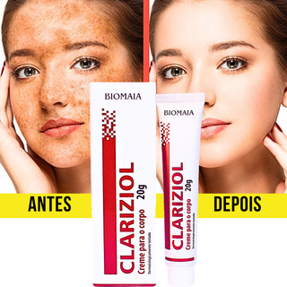 Melhor Creme Pra Melasma Remove Sarda Controla Acne Manchas Melhor Creme Pra Melasma Remove Sarda Controla Acne Manchas