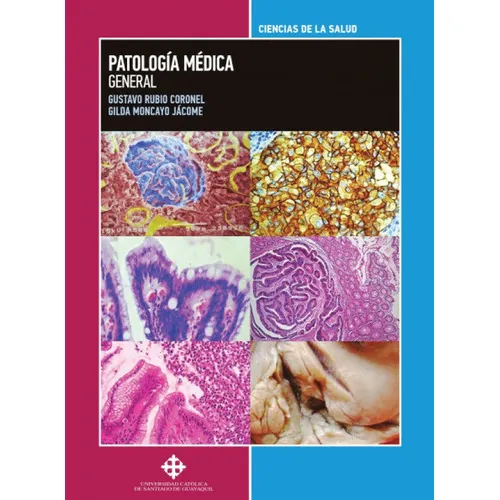 Patología Médica General, de Gilda Moncayo Jácome y Gustavo Rubio Coronel. Editorial Universidad Católica de Santiago de Guayaquil, tapa blanda en español, 2017