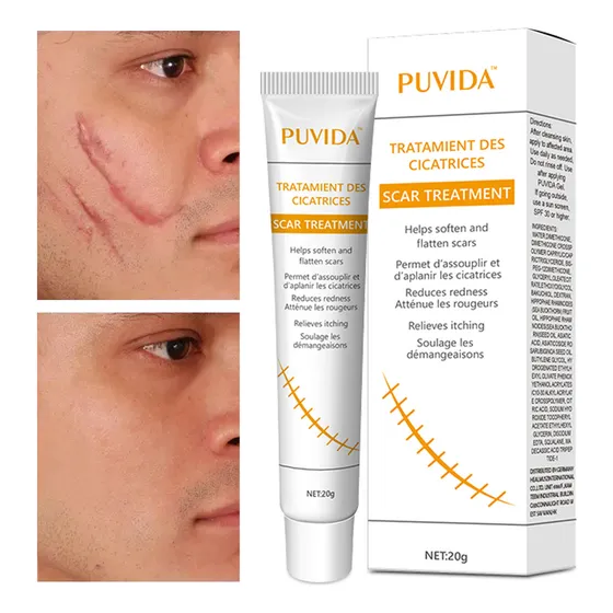 Crema Para Eliminar Cicatrices De Sutura, Quemaduras 20g