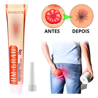 Pomada Para Hemorroida Externa Trombosada Sangrando Oferta Pomada Para Hemorroida Externa Trombosada Sangrando Oferta