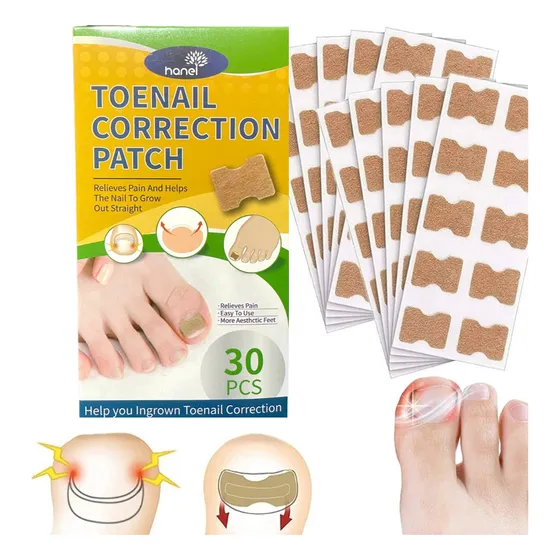 Pack Parches Para Corregir Uñas Encarnadas Encajadas
