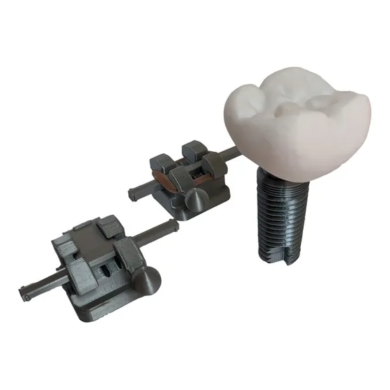 Macro Implante Y Par De Brackets Odontológicos Impresos 3d