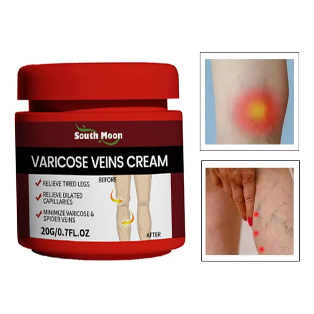 Crema Para Venas Varicosas, Trombosis, Vasculitis Natural