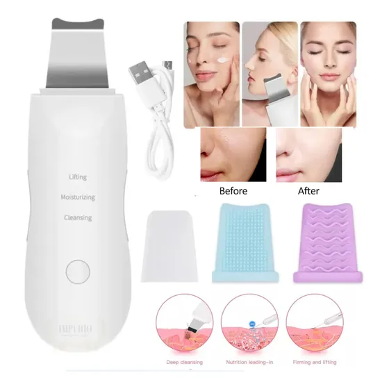Paleta De Peeling Ultrasónico Portátil Ionico Exfoliador