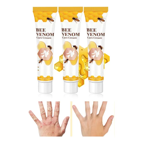Crema De Tratamiento Con Veneno De Abeja White Spot, 6 Unida