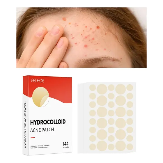 144x Adesivos Secantes Para Espinha E Acne - Hydrocolloid