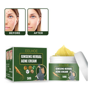 Crema Para Eliminar El Acné Con Hierba De Ginseng, Tratamien Crema Para Eliminar El Acné Con Hierba De Ginseng, Tratamien