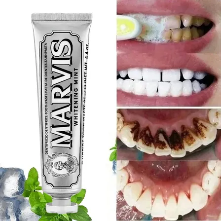 Creme Dental Marvis Clareador Removedor Manchas