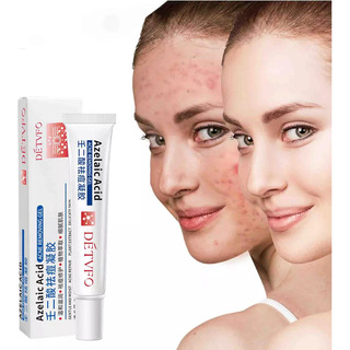 Útil Gel Retinoide Tópico Recetado Para La Cara Útil Gel Retinoide Tópico Recetado Para La Cara