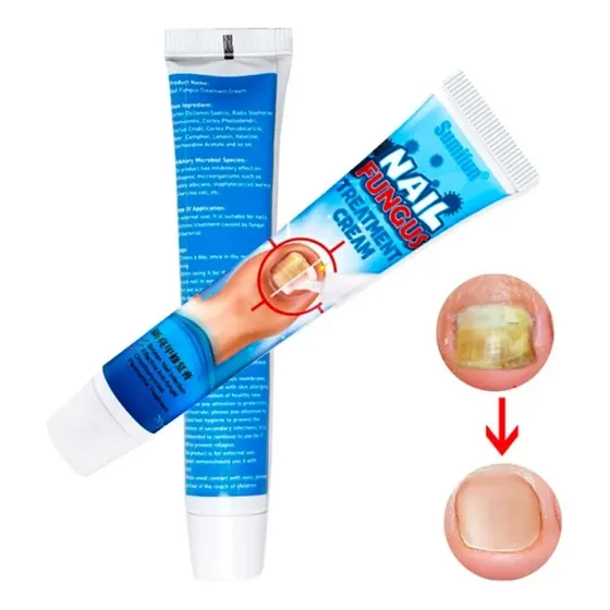 Crema Reparacion Hongos De Uñas Ataca Onicomicosis Pies New