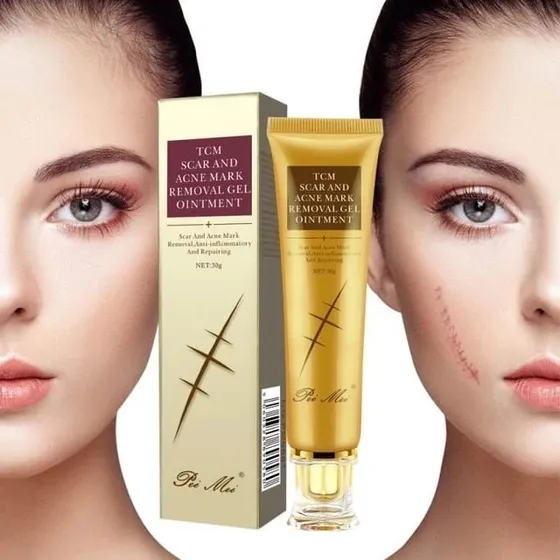 Crema Reparadora Cicatrices Y Estrías, Facial Y Corporal