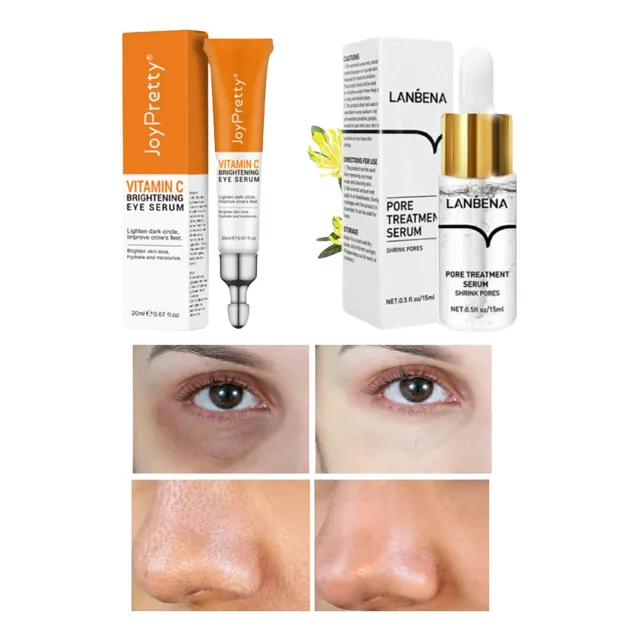 Pack Vitamina C Elimina Las Ojeras Y  Elimina Puntos Negros 