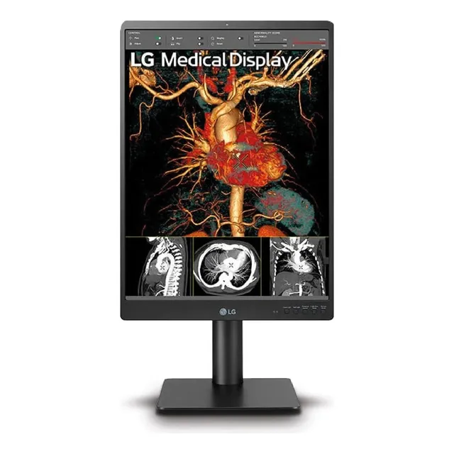 Monitor Diagnostico Radiología General Color Negro 21,3 