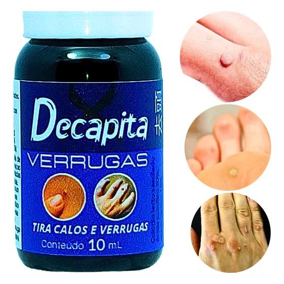 Remédio Para Verrugas Decapita Melhor Que Point Para Verruga