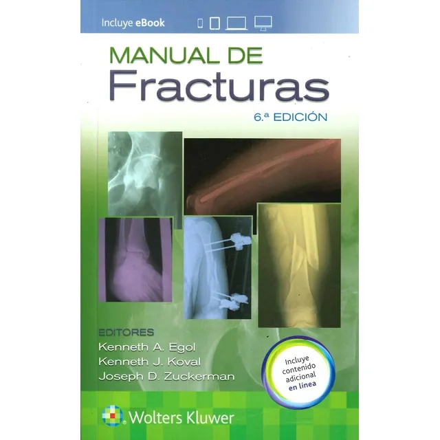 Egol / Manual De Fracturas / Orignal