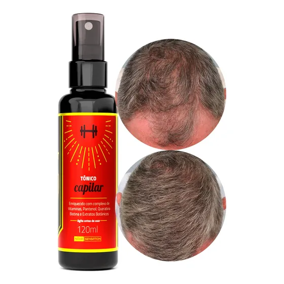 Produto Para Crescer Cabelo E Barba Tonico Crescimento Sérum