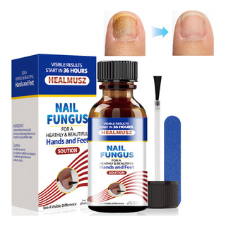 30ml Líquido Para Hongos En Las Uñas-tratamiento Para Uñas 30ml Líquido Para Hongos En Las Uñas-tratamiento Para Uñas