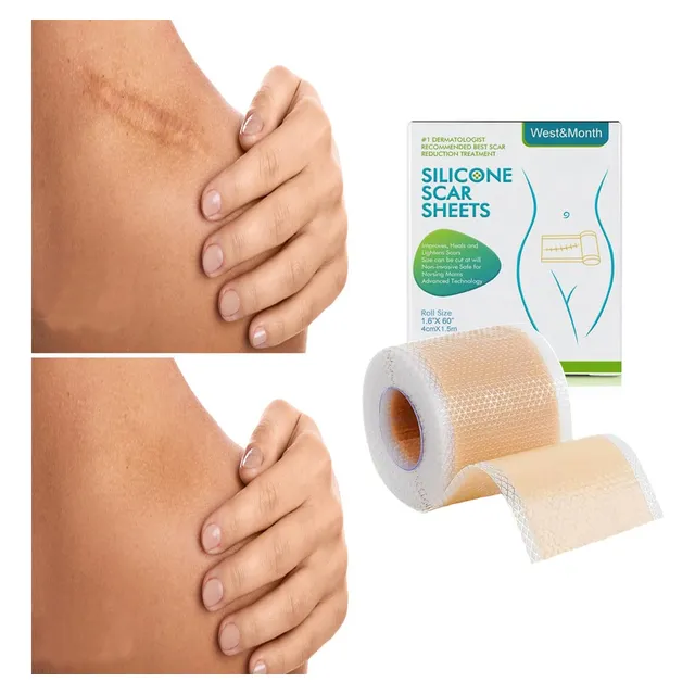 Cinta Silicona Para Eliminar Cicatrices