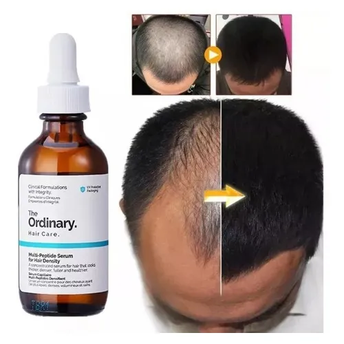 Multipeptides Hair Density. The Ordinary