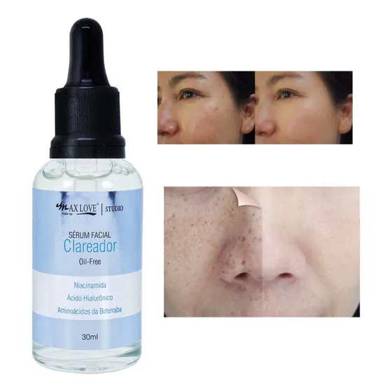 Creme Clareador Facial Intimo Pescoço Braço Mancha Escuras