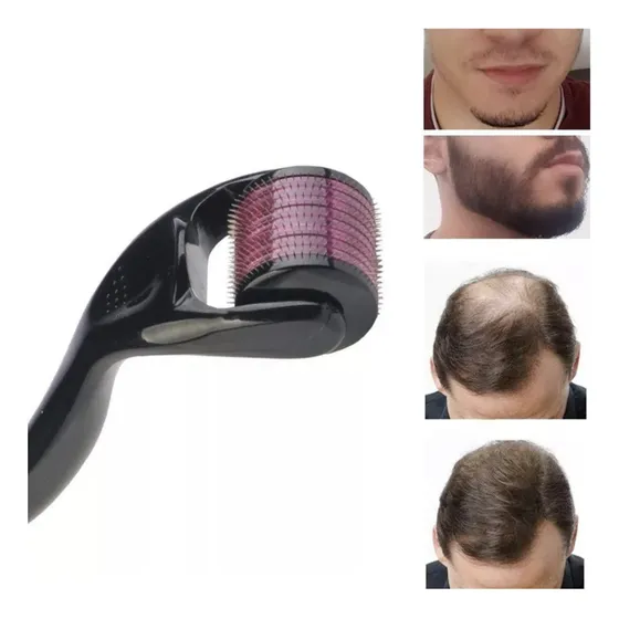 Derma Roller 540 Agujas | Alopecia Cicatrices Estrías 1.0mm