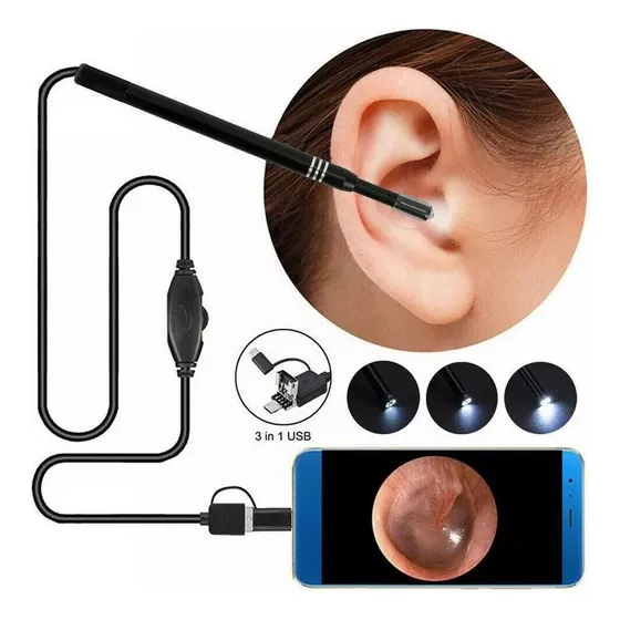Cámara Endoscopio Wifi De Oídos, Otoscopio Con 6 Led's