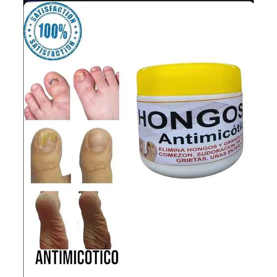 Hongos Dile A Dios Antimicotico No Más Uñas Maltratadas