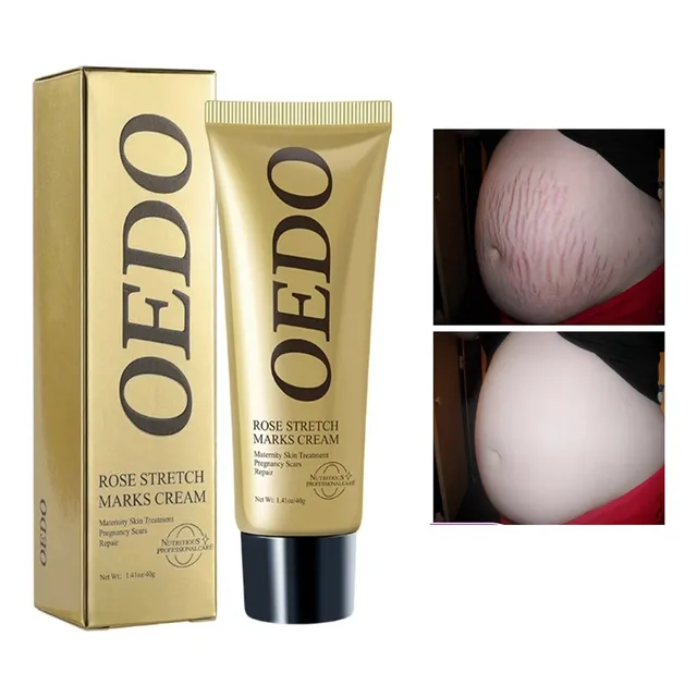 Crema Para Borrar Estrías De Embarazo 100% Original 2 Und