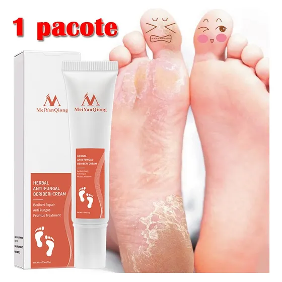/ Crema Eliminación Hongos En Las Uñas A Base Hierbas Lazhu