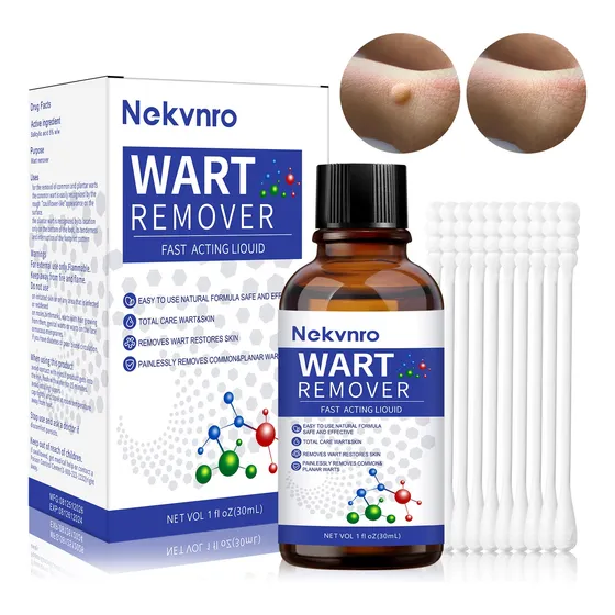 Líquido Para Verrugas Eliminación Sin Dolor, Cuidado Suave