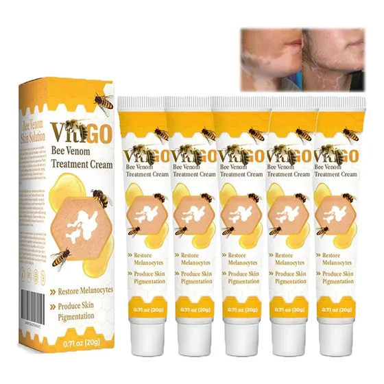 Crema De Tratamiento De Veneno De Abeja Vitiligo 5pcs