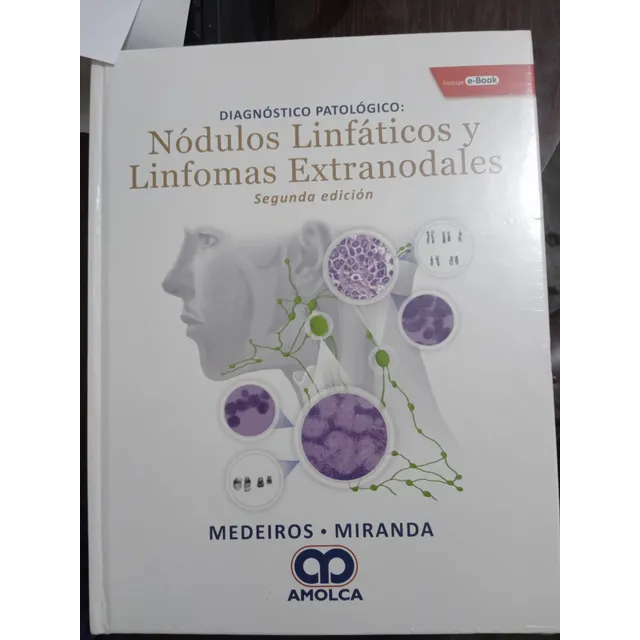 Nódulos Linfáticos Y Linfomas Extranodales Miranda Amolca