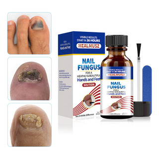 Líquido Hongo Uñas Tratamiento Uña Manos Y Pies 30ml Líquido Hongo Uñas Tratamiento Uña Manos Y Pies 30ml
