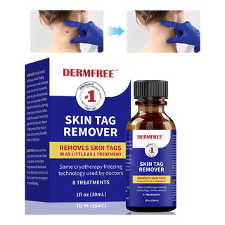 Líquida Para Eliminar Verrugas, Quitar Callos, Durezas 30ml Líquida Para Eliminar Verrugas, Quitar Callos, Durezas 30ml
