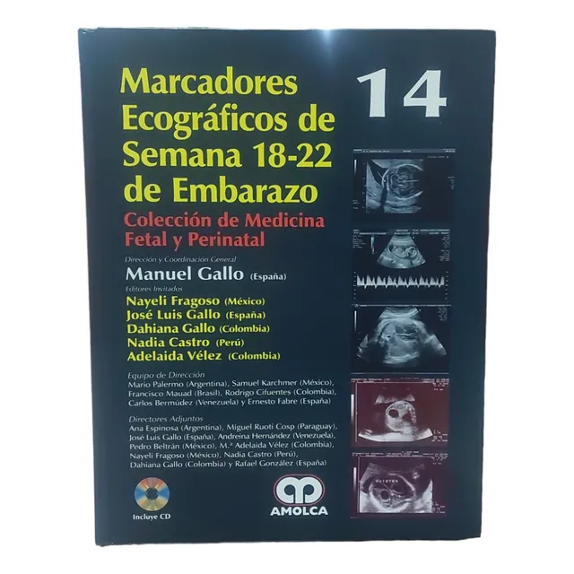Cmfp 14. Marcadores Ecográficos De Semana 18-22 De Embarazo