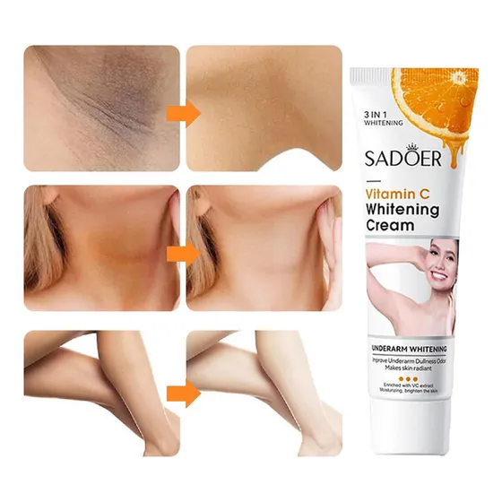 Crema Blanqueadora De Piel Para El Cuerpo, Crema Aclaradora