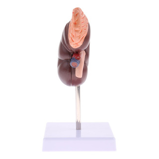 Modelo Anatómico Extraíble De Riñón Humano Material De Modelo Anatómico Extraíble De Riñón Humano Material De