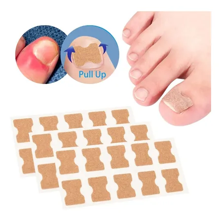 Kit 30 Adesivos Desencravadores Unha Podologia Corretor Dedo