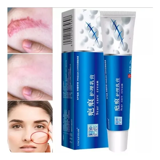 Crema Elimina 100% Cicatriz Queloides Manchas 20 G. Eficaz!