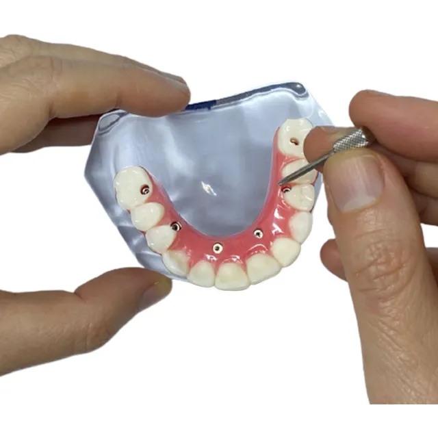 Modelo De Prótese Dentária ,modelo Protocolo