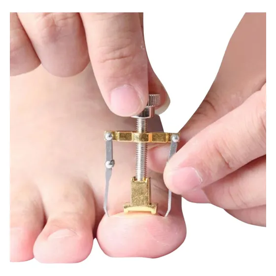 Desencravador De Unhas Encravadas Oriental Instantâneo