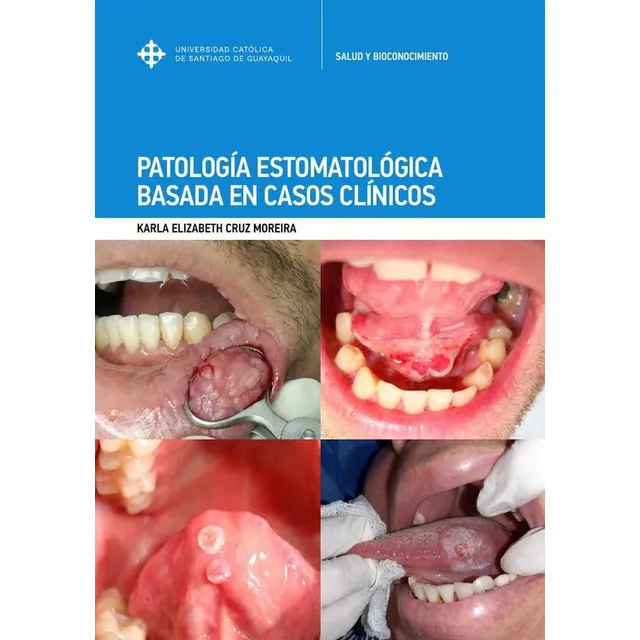Patología Estomatológica Basada En Casos Clínicos