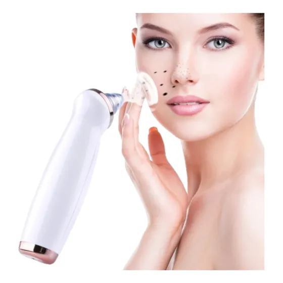 Tratamento Facial Dermoabrasão Led Removedor Cravos, Acne 