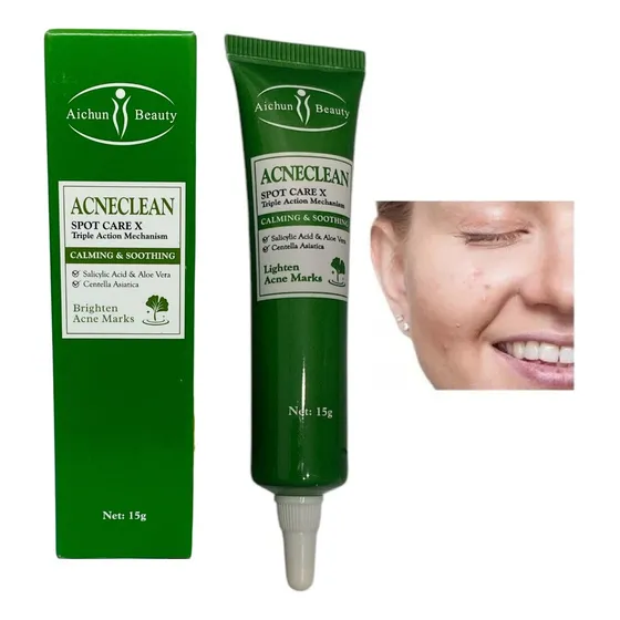 Crema Gel Elimina Acné Cicatrices Manchas Seca Espinillas Piel Grasa - Mixta - Todo Tipo De Piel Día/noche