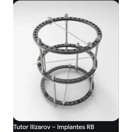 Tutor Ilizarov ( Usado )