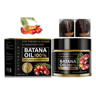 Pelo Aceite De Para El Crecimiento Suero Del Cabello Pelo Aceite De Para El Crecimiento Suero Del Cabello