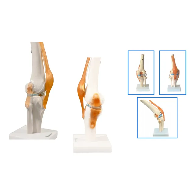Articulação Do Joelho Com Ligamentos Tamanho Real - Anatomia
