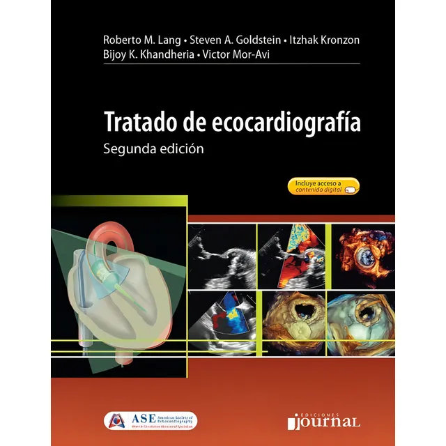 Ecocardiografía Tratado 